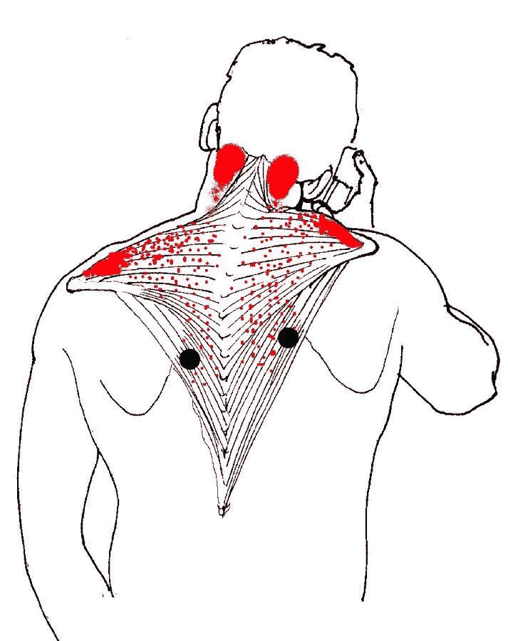 cervicale e mal di schiena